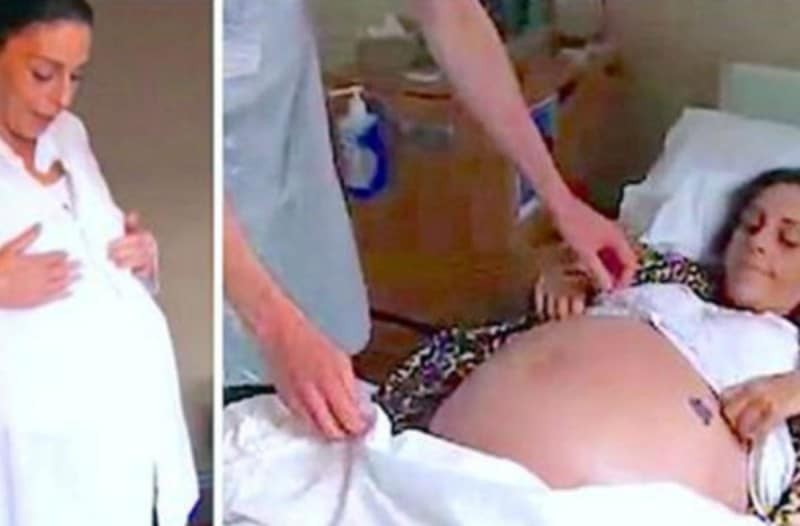 35χρονη έβλεπε την κοιλιά της να μεγαλώνει και νόμιζε ότι ήταν έγκυος - Όταν την εξέτασαν οι γιατροί...