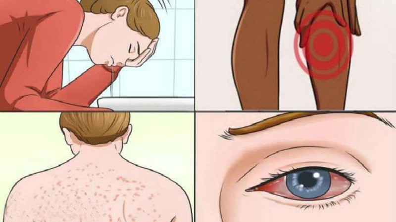 Δεν έχετε ιδέα: 17 συμπτώματα της ασθένειας της μούχλας και πώς να την καταπολεμήσετε