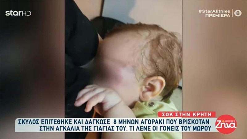 Συγκλονίζει η μητέρα του 8 μηνών βρέφους που δέχτηκε επίθεση από λυκόσκυλο: «Δεν ήξερα εάν είχε μάτι» (video)
