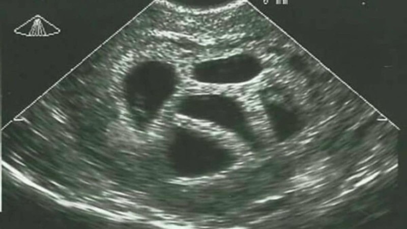 Μια έγκυος γυναίκα αγνόησε τις συμβουλές του γιατρού να κάνει έκτρωση... 20 χρόνια αργότερα δημοσιεύει αυτό!