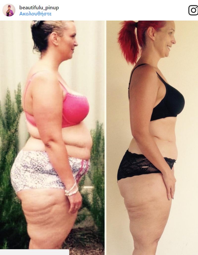 Απίστευτη αλλαγή: Έχασε 70 κιλά κόβοντας μόλις 4 τρόφιμα από την διατροφή της!
