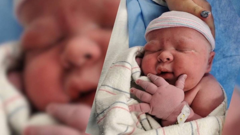 Γυναίκα έφερε στον κόσμο μωρό που ζυγίζει... 6,3 κιλά! Γεννήθηκε ο μικρός 