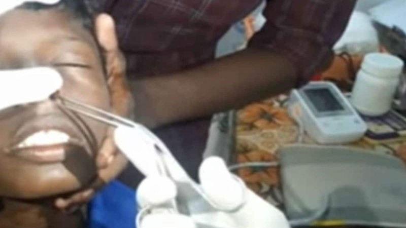 13χρονος παραπονιόταν πως πονούσε η μύτη του - Αυτό που βρήκαν οι γιατροί τους έκοψε την ανάσα