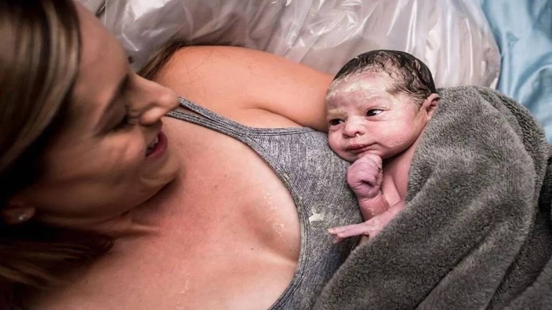 Στη γέννα παρατήρησαν κάτι πολύ παράξενο στο κεφάλι του μωρού - Δεν φαντάζεστε τι ανακάλυψαν (Video)