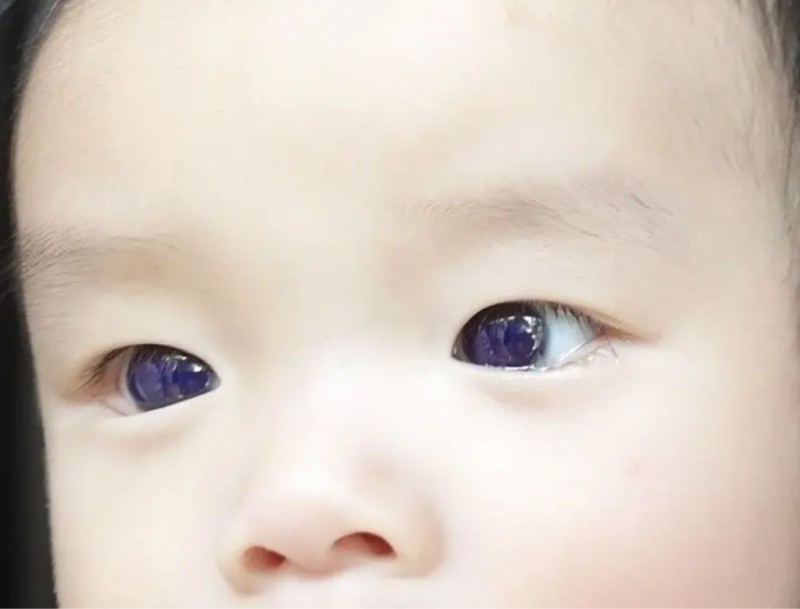 Άλλαξε το χρώμα ματιών ενός μωρού
