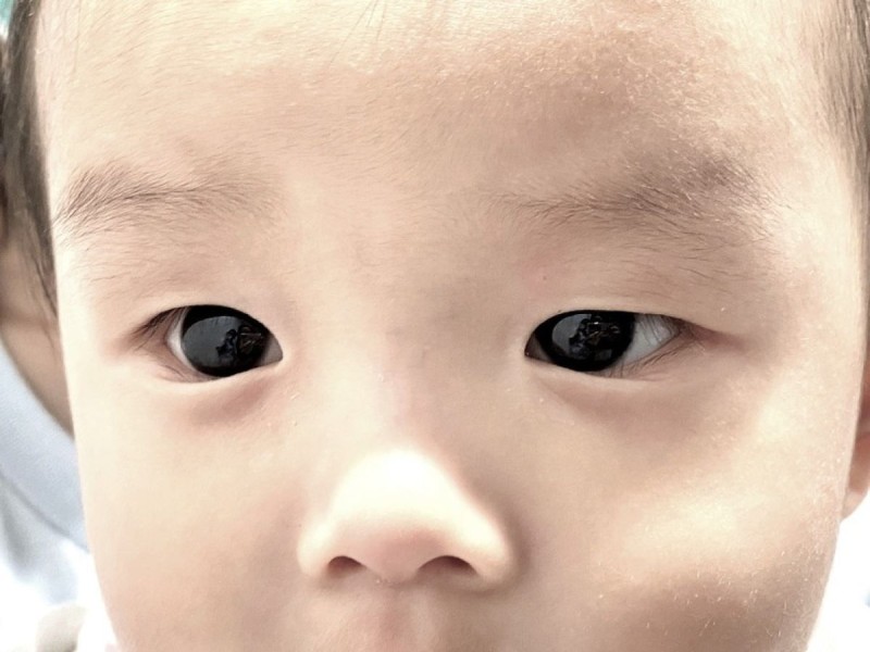 Άλλαξε το χρώμα ματιών ενός μωρού