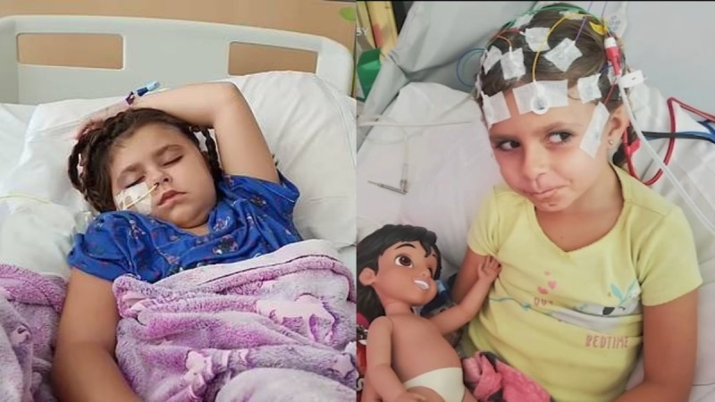 Γιατροί αποσύνδεσαν τον μισό εγκέφαλο 6χρονης με σπάνια νευρολογική ασθένεια - Η μικρούλα υποβλήθηκε σε ημισφαιρεκτομή (video)