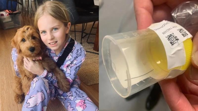 Σώθηκε την τελευταία στιγμή: 9χρονη κόντεψε να πνιγεί από ένα σάντουιτς - Μεταλλική τρίχα τρύπησε τον οισοφάγο της 