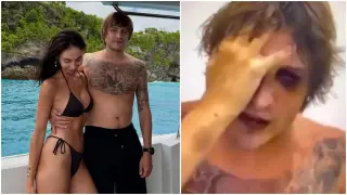 Θρίλερ με αποκεφαλισμένο πτώμα που εικάζεται ότι ανήκει στον Ιγκόρ Κομάροφ