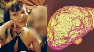 Το ιατρικό εύρημα στην 31χρονη