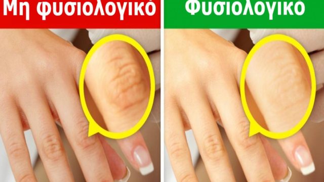 Κοιτάξτε τώρα προσεκτικά τα χέρια σας – Εάν έχετε κάποιο αυτά τα 9 σημάδια, επισκεφθείτε οπωσδήποτε τον γιατρό σας!