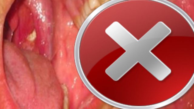 H αναπνοή της βρωμούσε τόσο άσχημα που αναγκάστηκε να πάει σε γιατρό – Δείτε τι κρυβόταν και μεγάλωνε μέσα στο στόμα της!