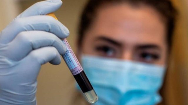 Κορωνοϊός: Συνεχίζει να «βράζει» η Αττική – Μικρές ανακουφίσεις στην υπόλοιπη χώρα