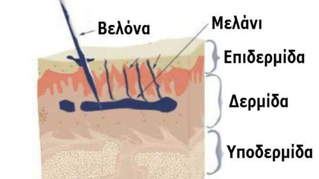 Δείτε τι πραγματικά συμβαίνει στο δέρμα μας όταν κάνουμε τατουάζ (Video)
