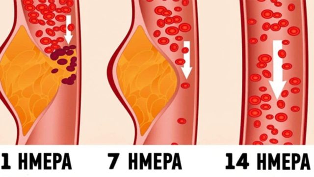 Τι είναι η δίαιτα ΝΤΑΣ και γιατί οι γιατροί τη θεωρούν μια από τις καλύτερες για την υγεία μας
