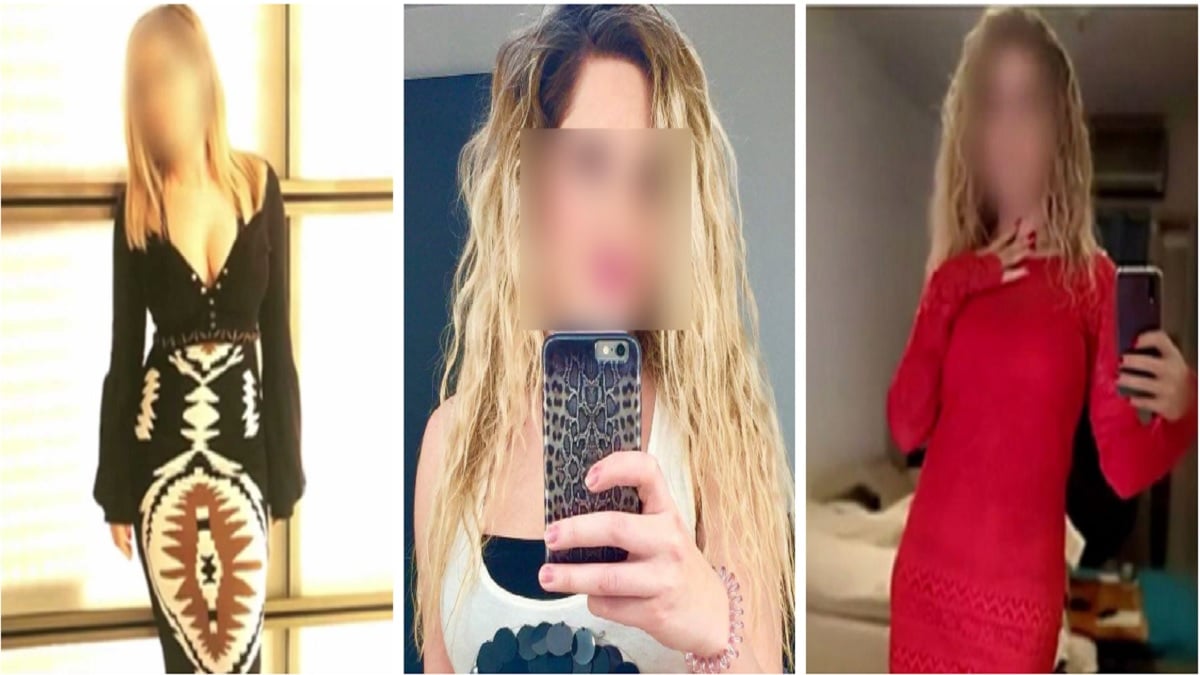 Επίθεση με βιτριόλι: «Η Ιωάννα κοιμάται και ξυπνάει με μια ειδική μάσκα»
