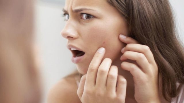 DIY: Ο σίγουρος τρόπος για να εξαφανίσεις τα σπυράκια!