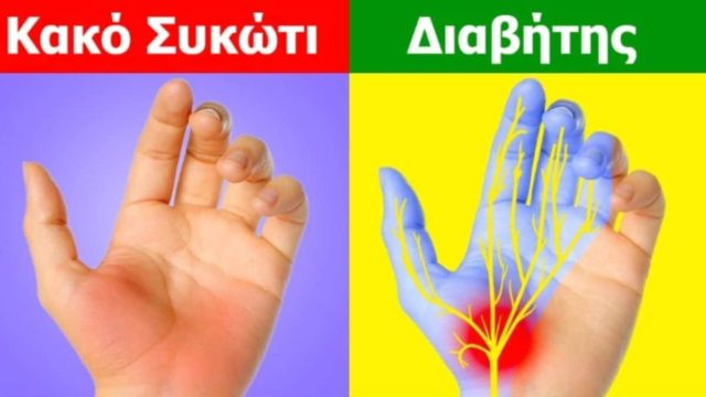 7 ανησυχητικά σημάδια στα χέρια που φανερώνουν την κατάσταση της υγείας μας – Με ποιες παθήσεις συνδέονται