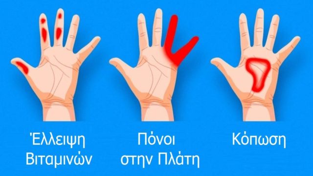 7 σημαντικά πράγματα που δείχνουν τα χέρια για την υγεία μας και δεν θα πρέπει να αγνοήσουμε