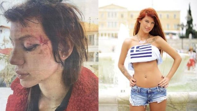 Σοκάρει η Μαρία Αλεξάνδρου για τον ξυλοδαρμό της: “Εύχομαι να τιμωρηθούν από τη δικαιοσύνη”