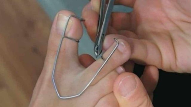 Μπορεί να μην καταλαβαίνετε τι βλέπετε στην φωτογραφία αλλά πρέπει να το κάνετε – Σώσει ζωές! (Video)