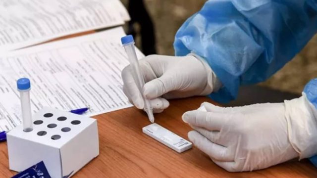 Κορωνοϊός: Ανατροπή με τα self tests – Δε θα γίνονται στα φαρμακεία