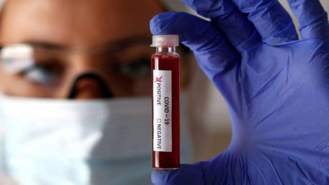 Είδηση σοκ: Αγγίζουν τα 4.000 τα κρούσματα στην Ελλάδα σήμερα (23/03)