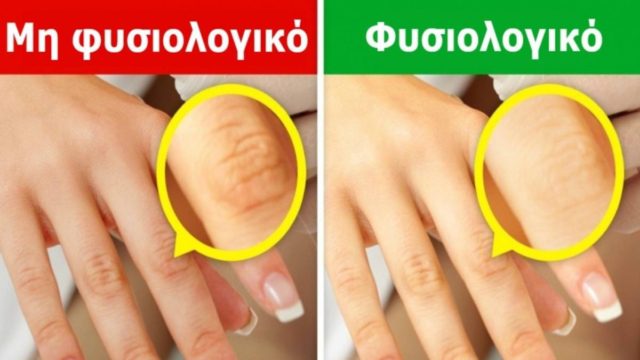 Κοιτάξτε τώρα προσεκτικά τα χέρια σας – Εάν έχετε κάποιο αυτά τα 9 σημάδια, επισκεφθείτε οπωσδήποτε τον γιατρό σας!
