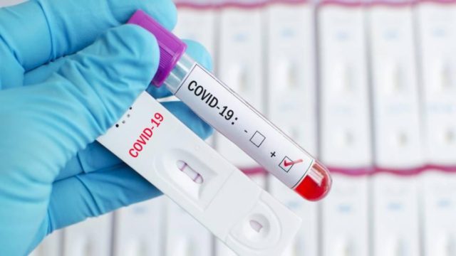 Self tests: Τι ισχύει από Δευτέρα για όλο τον ιδιωτικό τομέα