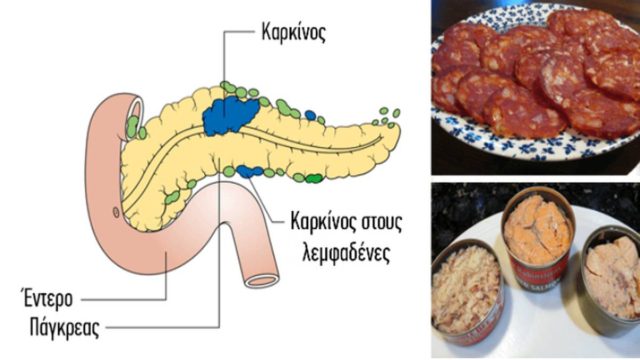 14 τροφές που έχουν αποδειχθεί ότι προκαλούν καρκίνο – Δεν πρέπει να ξαναβάλετε στο στόμα σας