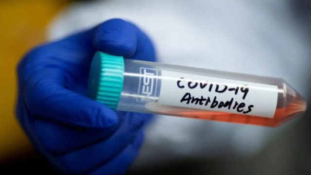 Μετά τον εμβολιασμό πρέπει να κάνω το τεστ αντισωμάτων; – Τι λένε οι ειδικοί -Έρχεται νέο κύμα πανδημίας μετά το καλοκαίρι