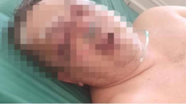 Αλβανός αγρότης σακάτεψε αστυνομικό με σιδερολοστό!