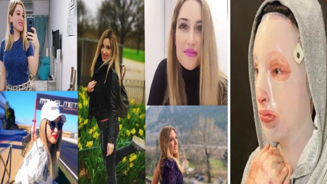 Επίθεση με βιτριόλι: «Η Ιωάννα είναι φυλακισμένη» – Ο Γολγοθάς της 35χρονης και οι μνήμες που ξύπνησαν απ’ τη Μονή Πετράκη (Video)