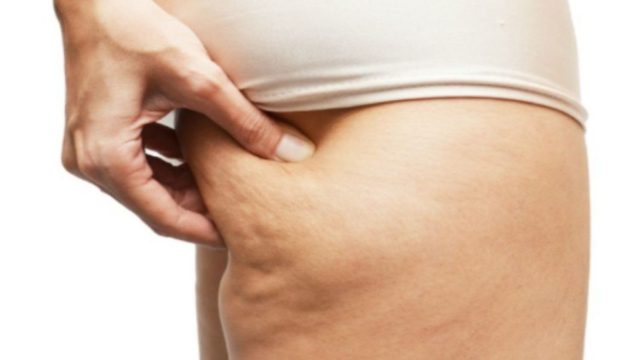 Κυτταρίτιδα ΤΕΛΟΣ: 7 άκρως αποτελεσματικοί τρόποι για να σφίξουν τα μπούτια σας!