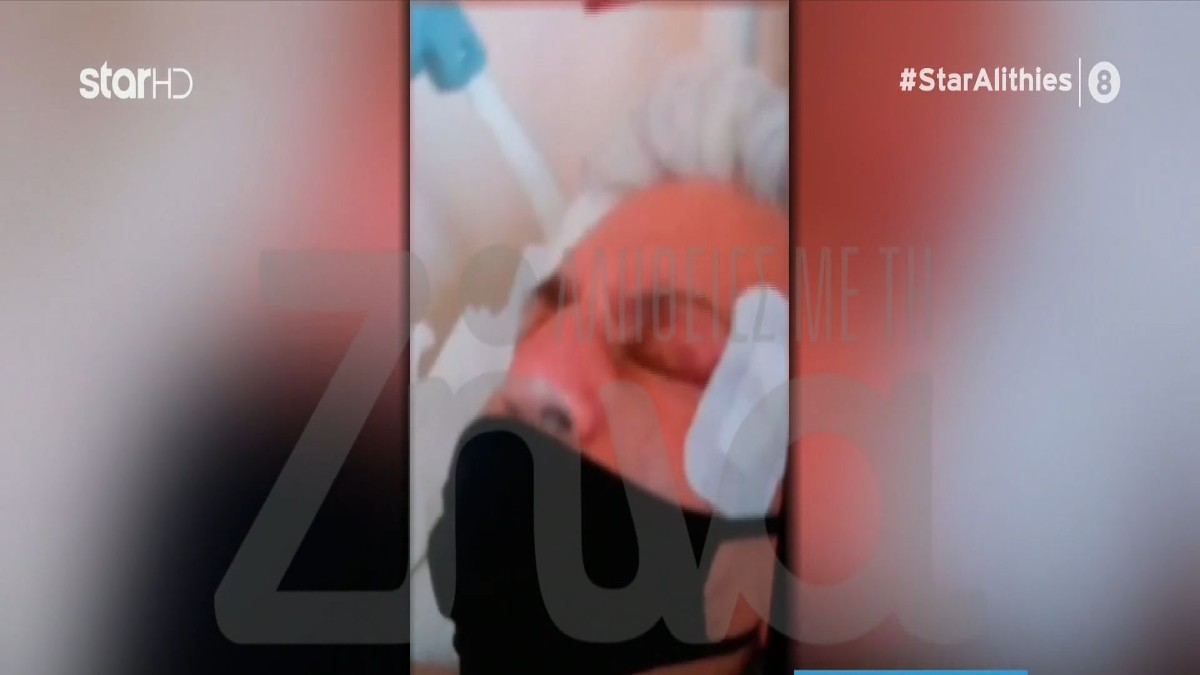 Ο Παναγιώτης Ψωμιάδης μέσα από το κρεβάτι του πόνου! Έτσι έγινε το τροχαίο – «Έσπασα δύο-τρία πλευρά και το ζυγωματικό…»