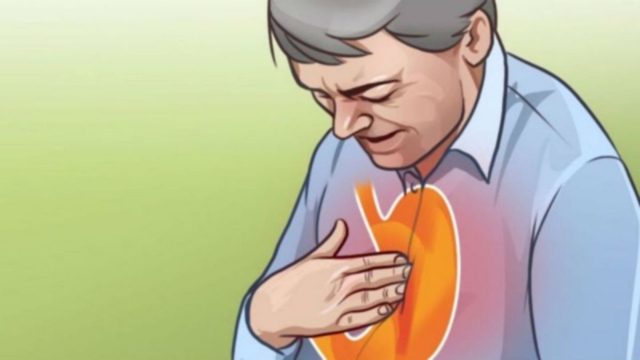 10+1 τροφές που αν τις περιορίσετε, θα απαλλαγείτε οριστικά από τις καούρες!