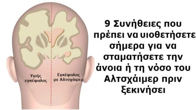 8+1 πράγματα που μπορείτε να κάνετε για να μην πάθετε άνοια – Δώστε ιδιαίτερη προσοχή στο 5ο