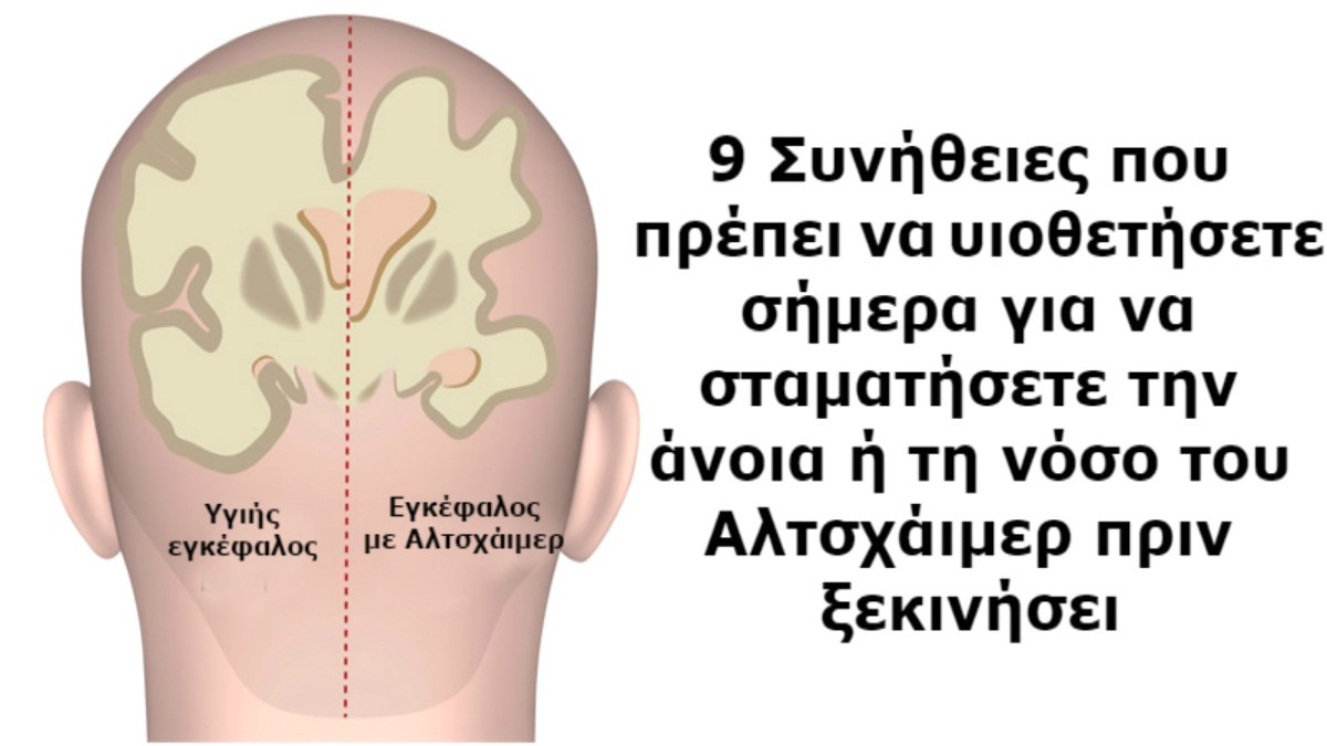 8+1 πράγματα που μπορείτε να κάνετε για να μην πάθετε άνοια – Δώστε ιδιαίτερη προσοχή στο 5ο