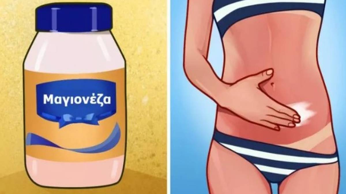 Παίρνει μια χούφτα μαγιονέζα και την απλώνει στην κοιλιά της. Λίγες ώρες αργότερα, μένει άφωνη με το αποτέλεσμα!