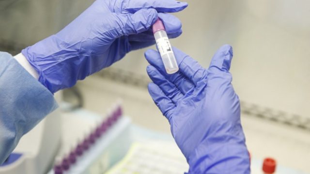 Οριστικό: Αυτοί είναι οι επόμενοι που θα εμβολιαστούν υποχρεωτικά!