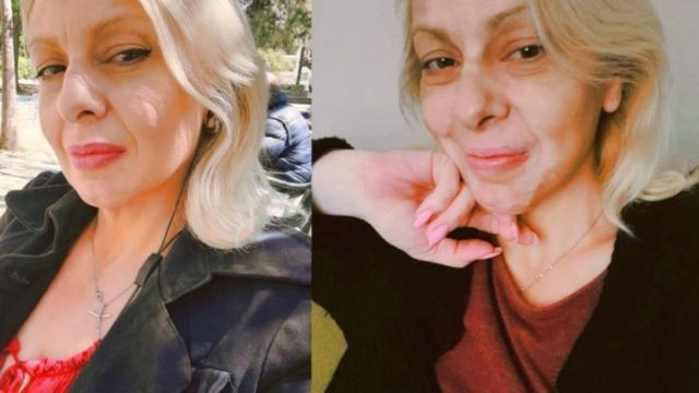 Πάλευα με λεύκη και καρκίνο ενώ μεγάλωνα μόνη 4 παιδιά. Ώσπου έβγαλα τα «σκουπίδια» από τη ζωή μου
