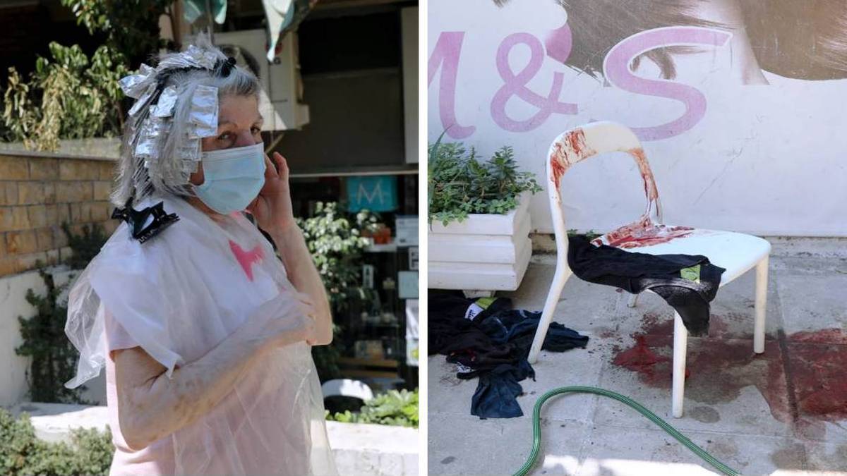 «Ελάτε έχω σκοτώσει κόσμο»: Σε αμόκ 54χρονος μαχαίρωσε περαστικούς με ματσέτα – Πολύ σκληρές εικόνες