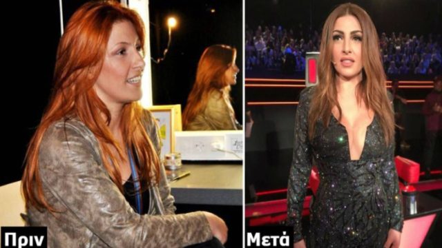Δίαιτα της λεπτίνης: Αυτή είναι η θαυματουργή δίαιτα της Έλενας Παπαρίζου