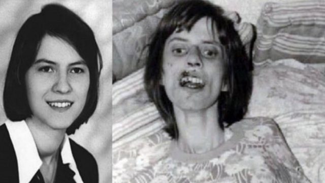 Πέθανε μετά από 67 συνεχόμενους εξορκισμούς. Η «υπόθεση της Ανελίζε» που αναστάτωσε τη Γερμανία και έγινε ταινία
