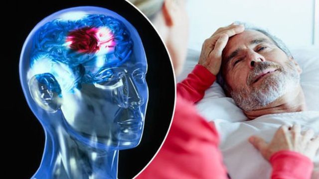Εγκεφαλικό: Προσοχή στα πρώιμα συμπτώματα – Πώς μπορείτε να το προλάβετε