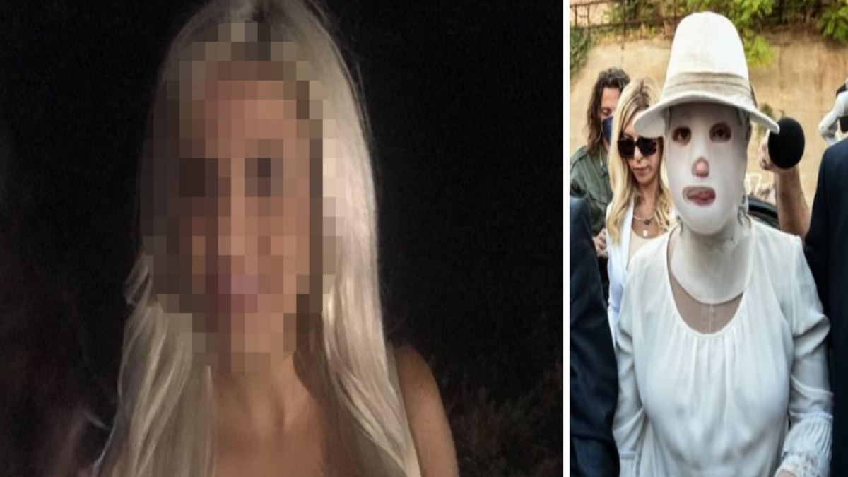 Επίθεση με βιτριόλι: Ψυχρή και κυνική δήλωση της 37χρονης για την απουσία της – Διακόπηκε η δίκη