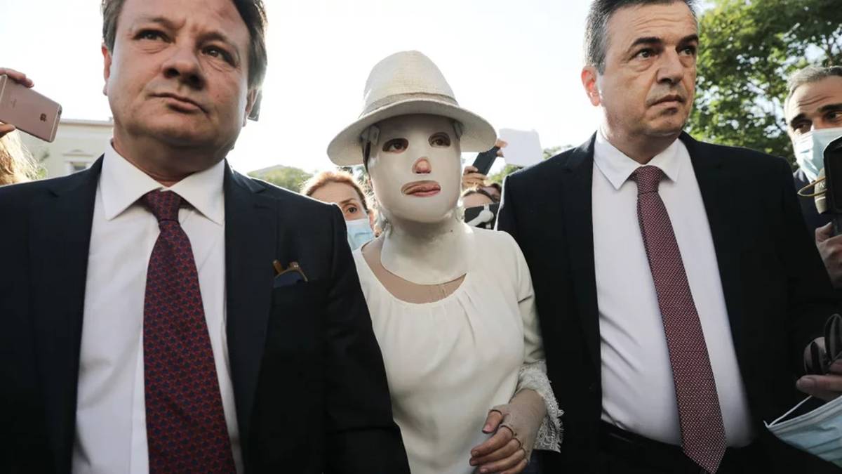 Επίθεση με βιτριόλι: Η Ιωάννα προσπάθησε να βρει… κι εκείνη καυστικό υγρό – «Προκαλεί θάνατο»