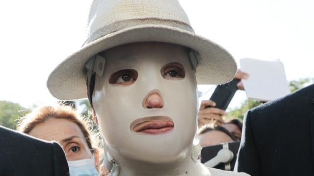 Επίθεση με βιτριόλι – Χειρουργός Ιωάννας: «Ανησυχώ βλέποντας το μεγάλο στρες να έχει επιπτώσεις στην υγεία της»