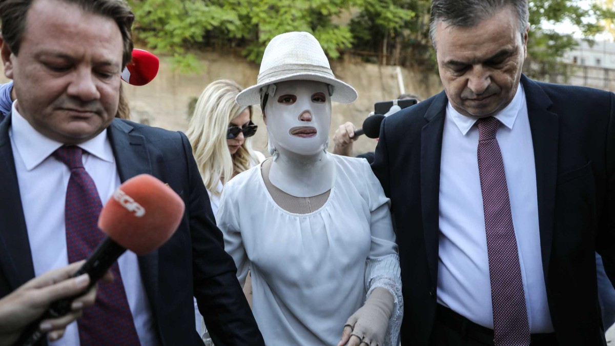 Επίθεση με βιτριόλι: Συγκλονίζει ο γιατρός της Ιωάννας – «Τυχερή που έχει το μάτι της»
