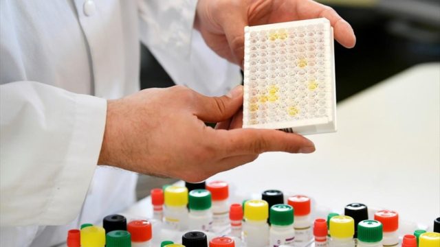 Αντισώματα κορωνοϊού: Πόσα πρέπει να έχουμε για να είμαστε ασφαλείς